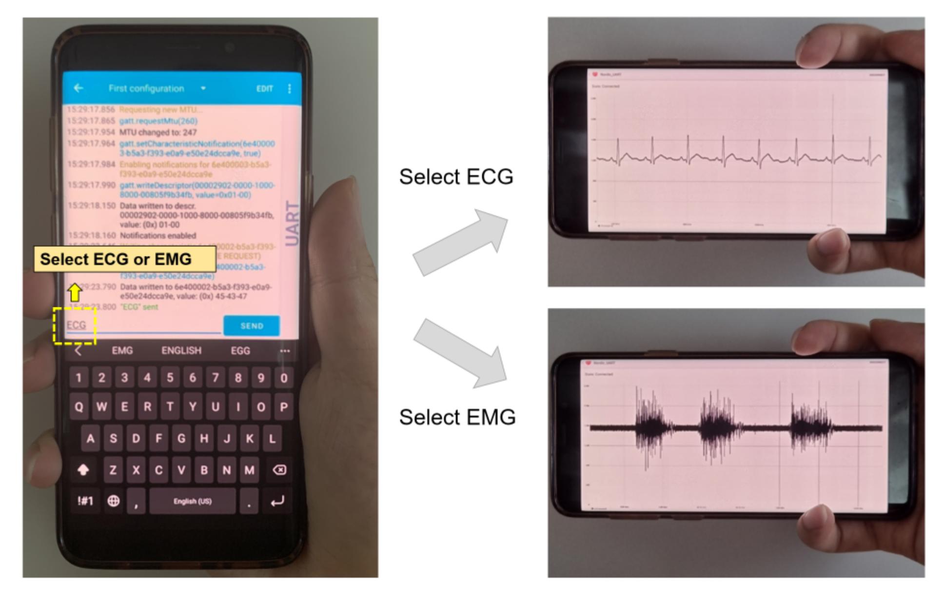 Sensors | Free Full-Text | A Real-Time Wearable Physiological ...